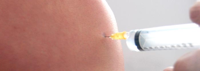 Biopunctuur